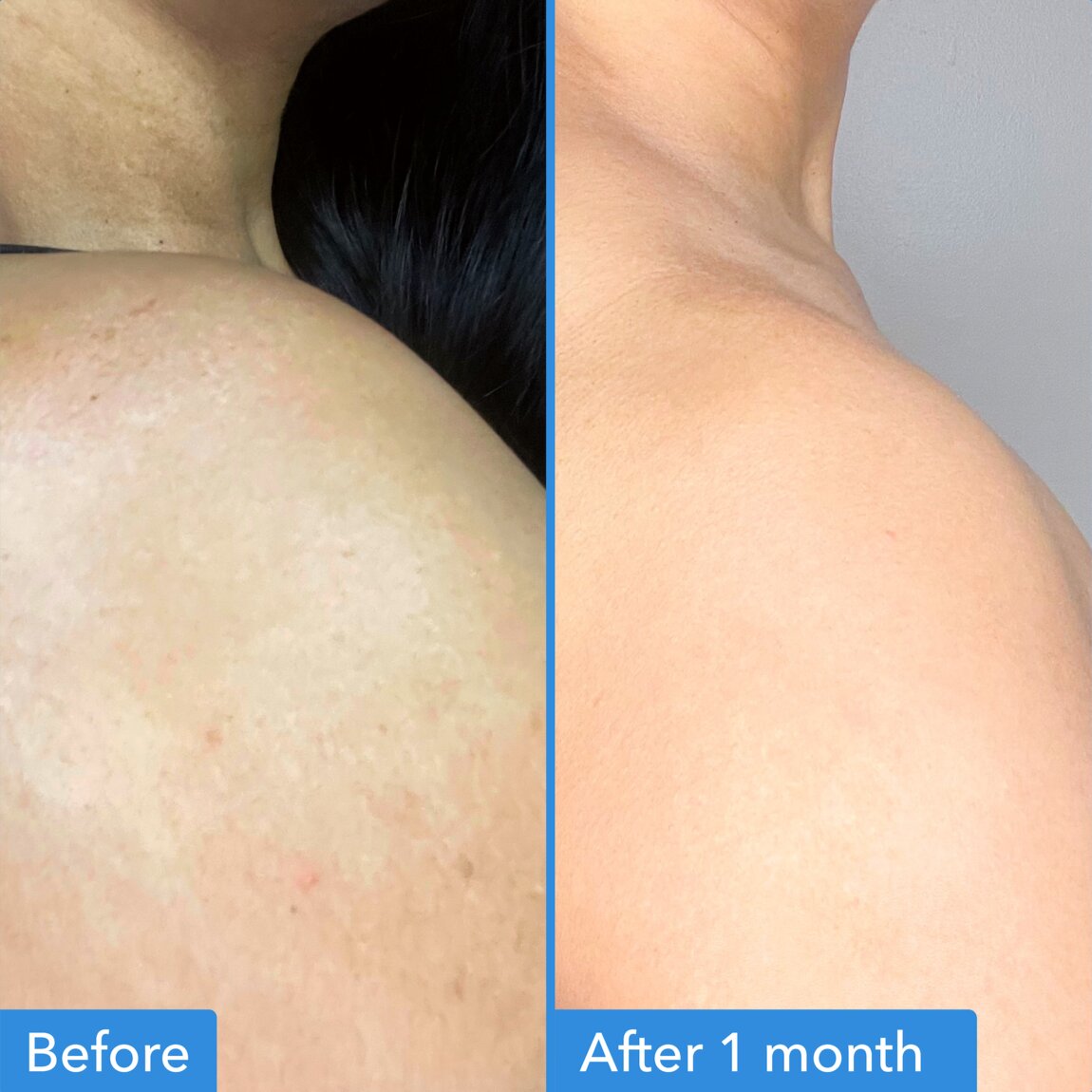 discoloration-correcting-body-treatment-k0 zb_p.jpg