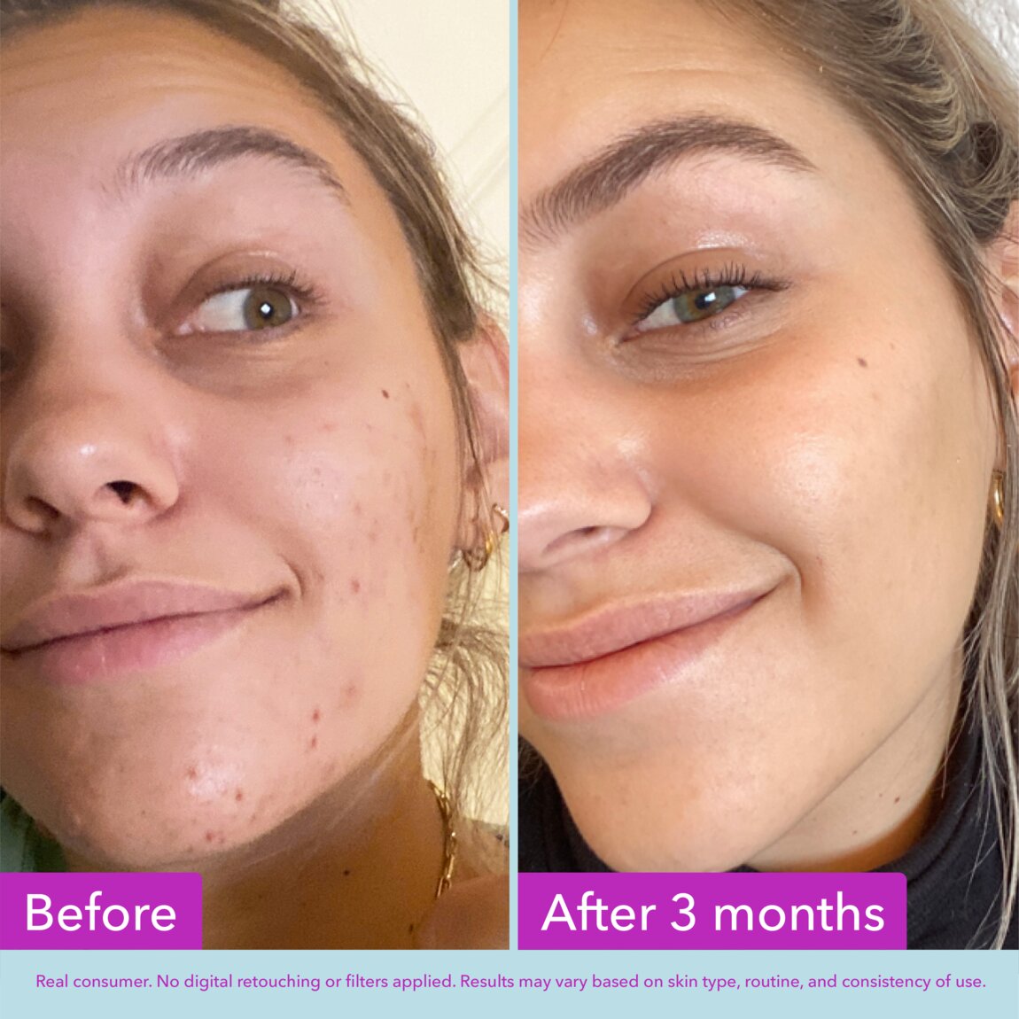 niacinamide-brightening-toner-p8 zb_p.jpg