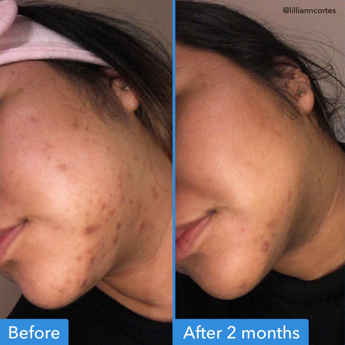 discoloration-correcting-serum-f8 zb_p.jpg